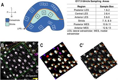 PCP auto count: a novel Fiji/ImageJ plug-in for automated quantification of planar cell polarity and cell counting
